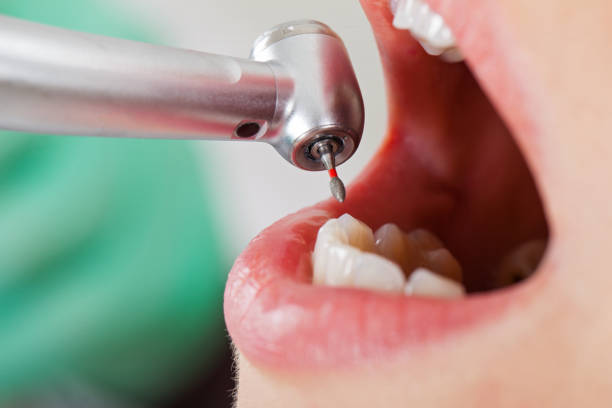 Best Cosmetic Emergency Dentistry in Seven Points, TX